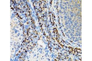 Immunohistochemistry of paraffin-embedded Rat ovary using SRP19 Polyclonal Antibody at dilution of 1:100 (40x lens). (SRP19 antibody)