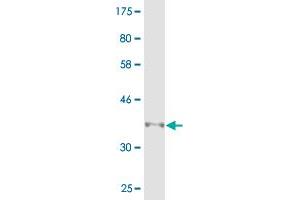 Western Blot detection against Immunogen (36. (Multimerin 1 antibody  (AA 291-390))