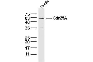 Mouse Testis lysates probed with Cdc25A Polyclonal Antibody, Unconjugated  at 1:300 dilution and 4˚C overnight incubation. (CDC25A antibody  (AA 451-524))