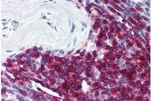 Human Spleen (formalin-fixed, paraffin-embedded) stained with CD5 antibody ABIN298515 at 20 ug/ml followed by biotinylated anti-mouse IgG secondary antibody ABIN481714, alkaline phosphatase-streptavidin and chromogen. (CD5 antibody)