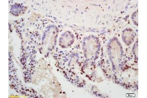 Formalin-fixed and paraffin embedded mouse intestine labeled with Rabbit Anti MSH2 Polyclonal Antibody, Unconjugated (ABIN672816) at 1:200 followed by conjugation to the secondary antibody and DAB staining (MSH2 antibody  (AA 101-200))