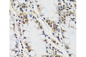 Immunohistochemistry of paraffin-embedded Human colon using CASC5 Polyclonal Antibody at dilution of 1:100 (40x lens). (CASC5 antibody)