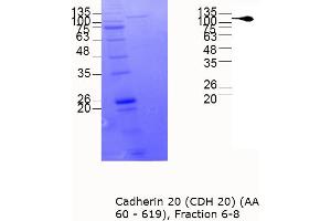 Western Blotting (WB) image for Cadherin 20 (CDH20) (AA 60-619) protein (MBP tag) (ABIN3107051) (Cadherin 20 Protein (CDH20) (AA 60-619) (MBP tag))