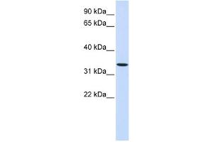 WB Suggested Anti-WNT6 Antibody Titration:  0. (WNT6 antibody  (Middle Region))