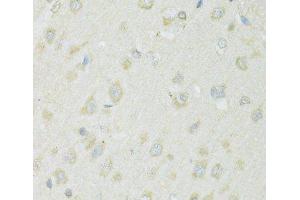 Immunohistochemistry of paraffin-embedded Rat brain using SLC22A5 Polyclonal Antibody at dilution of 1:100 (40x lens). (SLC22A5 antibody)