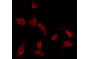 ABIN6275733 staining HepG2 by IF/ICC. (RNF113B antibody  (Internal Region))