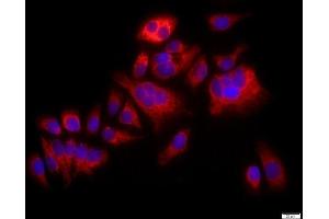 MCF-7 cells were stained with p38 MAPK Polyclonal Antibody, Unconjugated at 1:500 in PBS and incubated for two hours at 37°C followed by Goat Anti-Rabbit IgG (H+L) Cy3 conjugated secondary antibody. (MAPK14 antibody  (AA 141-240))