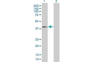 Western Blot analysis of HFE expression in transfected 293T cell line by HFE MaxPab polyclonal antibody.