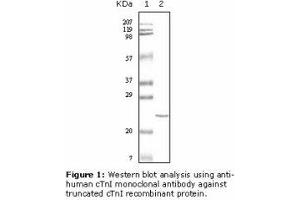 Image no. 2 for anti-Cardiac Troponin I (TNNI3) antibody (ABIN232097) (TNNI3 antibody)