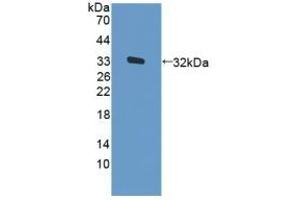 Detection of Recombinant PKR, Human using Polyclonal Antibody to Protein Kinase R (PKR) (EIF2AK2 antibody  (AA 224-502))