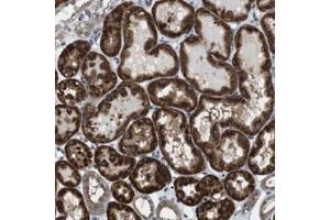 Immunohistochemical staining of human kidney with CD34 polyclonal antibody  shows strong cytoplasmic positivity in cells of tubules at 1:50-1:200 dilution.
