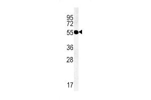 TMEM79 antibody  (C-Term)