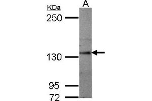 Western Blotting (WB) image for anti-Sema Domain, Seven thrombospondin Repeats (Type 1 and Type 1-Like), Transmembrane Domain (TM) and Short Cytoplasmic Domain, (Semaphorin) 5A (SEMA5A) (AA 700-1000) antibody (ABIN1501911) (SEMA5A antibody  (AA 700-1000))