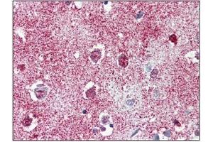 Immunohistochemistry: TAOK1 antibody staining of Formalin-Fixed, Paraffin-Embedded Human Brain, Cortex. (TAO Kinase 1 (TAOK1) (C-Term) antibody)