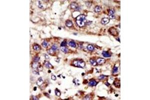 Image no. 2 for anti-Zinc Metalloproteinase, Ste24 (Zmpste24) (C-Term) antibody (ABIN357708) (ZMPSTE24 antibody  (C-Term))