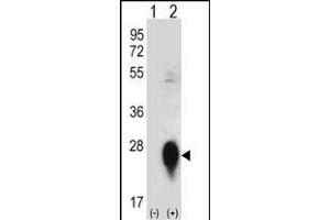Western blot analysis of CLEC3B (arrow) using rabbit polyclonal CLEC3B Antibody (Center) (ABIN656570 and ABIN2845832).