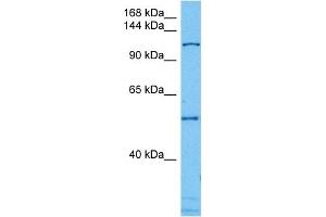 Host:  Mouse  Target Name:  CAND1  Sample Tissue:  Mouse Testis  Antibody Dilution:  1ug/ml (CAND1 antibody  (N-Term))