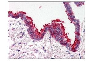 Image no. 1 for anti-SKI-Like Oncogene (SKIL) (N-Term) antibody (ABIN303248) (SKIL antibody  (N-Term))