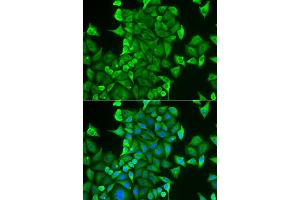 Immunofluorescence analysis of HeLa cells using CARS antibody (ABIN5973924). (CARS antibody)