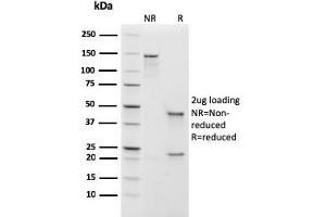 SDS-PAGE Analysis Purified IgM Recombinant Mouse Monoclonal Antibody (rIGHM/1623). (Recombinant IGHM antibody)