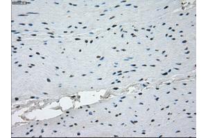 Immunohistochemical staining of paraffin-embedded endometrium tissue using anti-KDM4C mouse monoclonal antibody. (KDM4C antibody)
