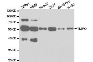 Western Blotting (WB) image for anti-Thymopoietin (TMPO) antibody (ABIN1875122)