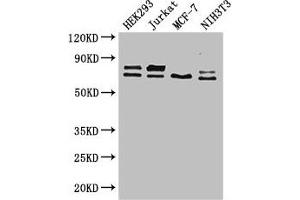 Western Blot Positive WB detected in: HEK293 whole cell lysate, Jurkat whole cell lysate, MCF-7 whole cell lysate, NIH/3T3 whole cell lysate All lanes: NF2 antibody at 2. (Merlin antibody  (AA 230-414))