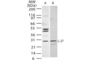 Image no. 1 for anti-Interleukin 27 (IL27) (AA 31-46) antibody (ABIN208552) (IL-27 antibody  (AA 31-46))