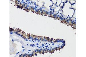 Immunohistochemistry of paraffin-embedded Mouse lung using SCGB1A1 Polyclonal Antibody at dilution of 1:100 (40x lens). (SCGB1A1 antibody)