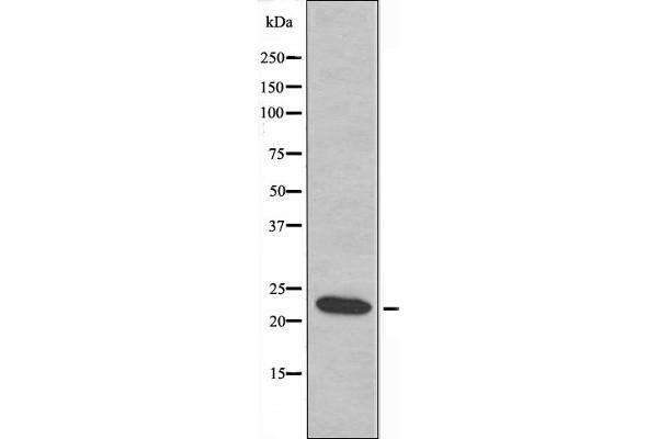 AKAP14 antibody  (N-Term)