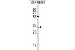 Western blot analysis in MDA-MB453 cell line lysates (35ug/lane). (FKBP6 antibody  (C-Term))