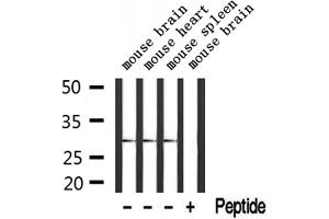 Western blot analysis of extracts from mouse brain and mouse heart and mouse spleen, using TSSK3 Antibody. (TSSK3 antibody  (N-Term))