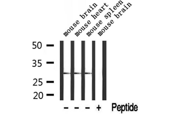 TSSK3 antibody  (N-Term)