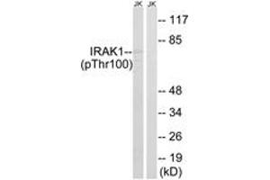 Western blot analysis of extracts from Jurkat cells treated with heat shock, using IRAK1 (Phospho-Thr100) Antibody. (IRAK1 antibody  (pThr100))