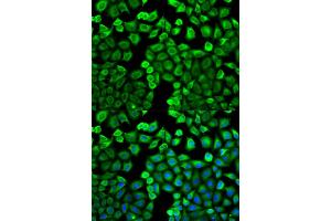 Immunofluorescence analysis of U2OS cells using HNMT antibody (ABIN5971352). (HNMT antibody)