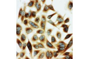Anti-HSPB2 antibody, ICC ICC: HELA Cell (HSPB2 antibody  (Middle Region))