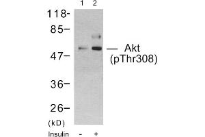 Western blot analysis using Akt (Phospho-Thr308) Antibody. (AKT1 antibody  (pThr308))