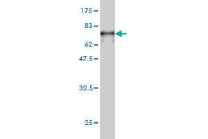 Western Blot detection against Immunogen (62. (NUDC antibody  (AA 1-331))