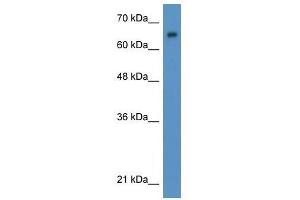 Western Blot showing WT1 antibody used at a concentration of 1-2 ug/ml to detect its target protein. (WT1 antibody  (N-Term))