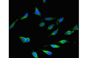 Immunofluorescent analysis of Hela cells using ABIN7151457 at dilution of 1:100 and Alexa Fluor 488-congugated AffiniPure Goat Anti-Rabbit IgG(H+L) (EHD2 antibody  (AA 401-543))
