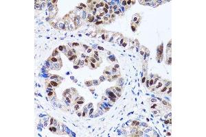 Immunohistochemistry (Paraffin-embedded Sections) (IHC (p)) image for anti-Ubiquitin-Like, Containing PHD and RING Finger Domains, 1 (UHRF1) (AA 1-260) antibody (ABIN3023232)