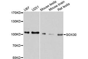 Western blot analysis of extracts of various cell lines, using SOX30 antibody. (SOX30 antibody  (AA 604-753))