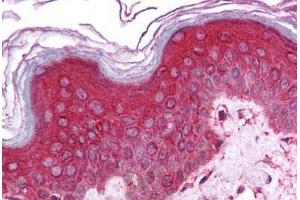Human Skin (formalin-fixed, paraffin-embedded) stained with CHRNA9 antibody ABIN214741 at 5 ug/ml followed by biotinylated goat anti-rabbit IgG secondary antibody ABIN481713, alkaline phosphatase-streptavidin and chromogen. (CHRNA9 antibody  (N-Term))