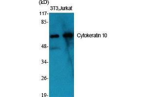 Western Blot (WB) analysis of specific cells using Cytokeratin 10 Polyclonal Antibody. (Keratin 10 antibody  (Internal Region))