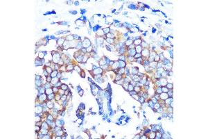 Immunohistochemistry (IHC) image for anti-Histone Deacetylase 6 (HDAC6) antibody (ABIN7267711)