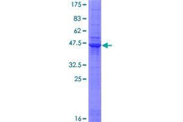 Chromosome 1 Open Reading Frame 84 (C1orf84) (AA 1-178) protein (GST tag)