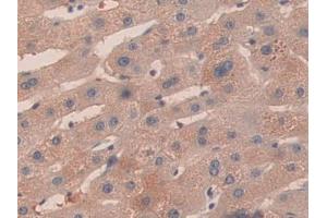 Used in DAB staining on fromalin fixed paraffin- embedded kidney tissue (KIR2DS2 antibody  (AA 22-304))