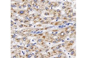 Immunohistochemistry analysis of paraffin-embedded human liver using,AGXT (ABIN7072987) at dilution of 1: 2000 (AGXT antibody)