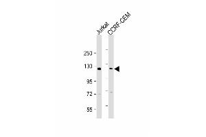 All lanes : Anti-GLI2 Antibody (C-term) at 1:2000 dilution Lane 1: Jurkat whole cell lysate Lane 2: CCRF-CEM whole cell lysate Lysates/proteins at 20 μg per lane. (GLI2 antibody  (C-Term))