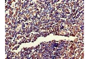 Immunohistochemistry of paraffin-embedded human tonsil tissue using ABIN7142764 at dilution of 1:100 (RPL19 antibody  (AA 79-196))